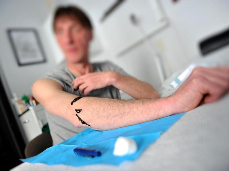 Leech Therapy: Ancient healing tech