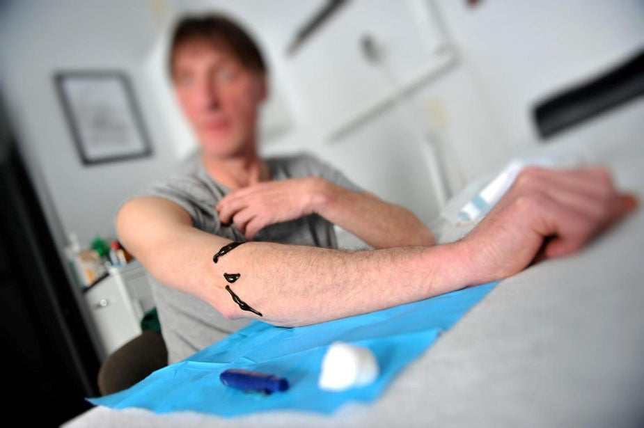 Leech Therapy: Ancient healing tech
